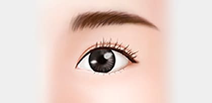 目の手術 - アンチエイジング(anti aging)