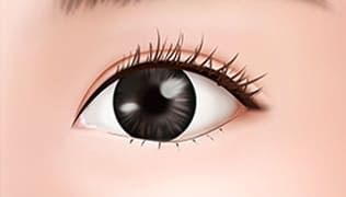 目の手術 - 二重(eye)